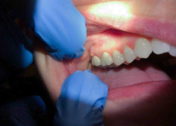 Best Urgent Dental Care for Toothache in Oxon Hill, MD